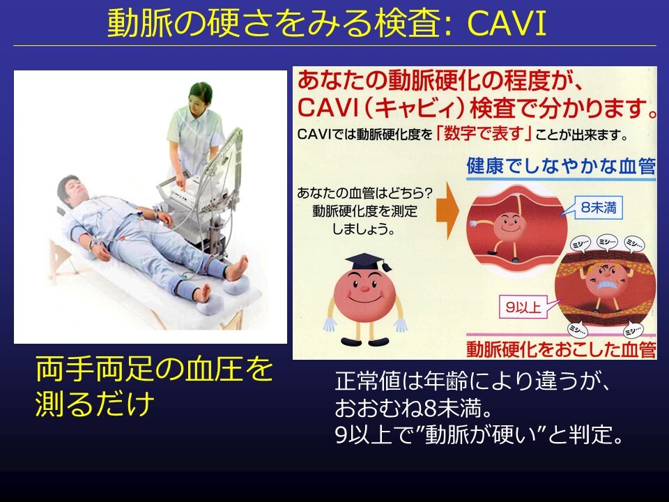 動脈硬化判定検査（CAVI, ABI）